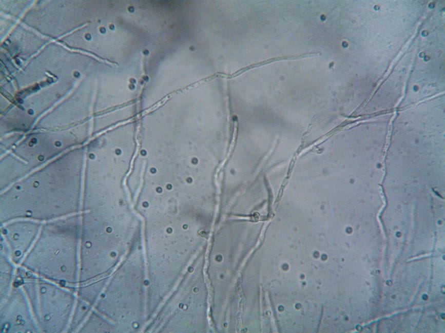The Hidden Network Beneath Your Roots: What Mycorrhizae Do for Cannabis