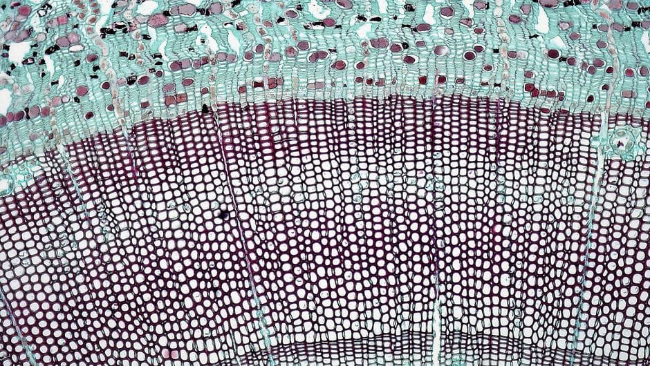 Why Psychedelics Make Everything Feel Connected: A Neuron-Level Answer