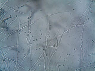 The Hidden Network Beneath Your Roots: What Mycorrhizae Do for Cannabis