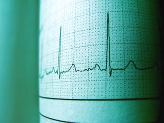 Inhaled Cannabis May Suppress Irregular Heartbeats in Regular Users