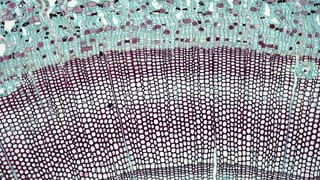 Why Psychedelics Make Everything Feel Connected: A Neuron-Level Answer