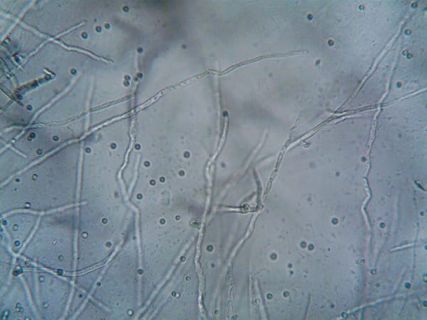 The Hidden Network Beneath Your Roots: What Mycorrhizae Do for Cannabis