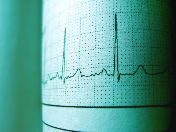 Inhaled Cannabis May Suppress Irregular Heartbeats in Regular Users